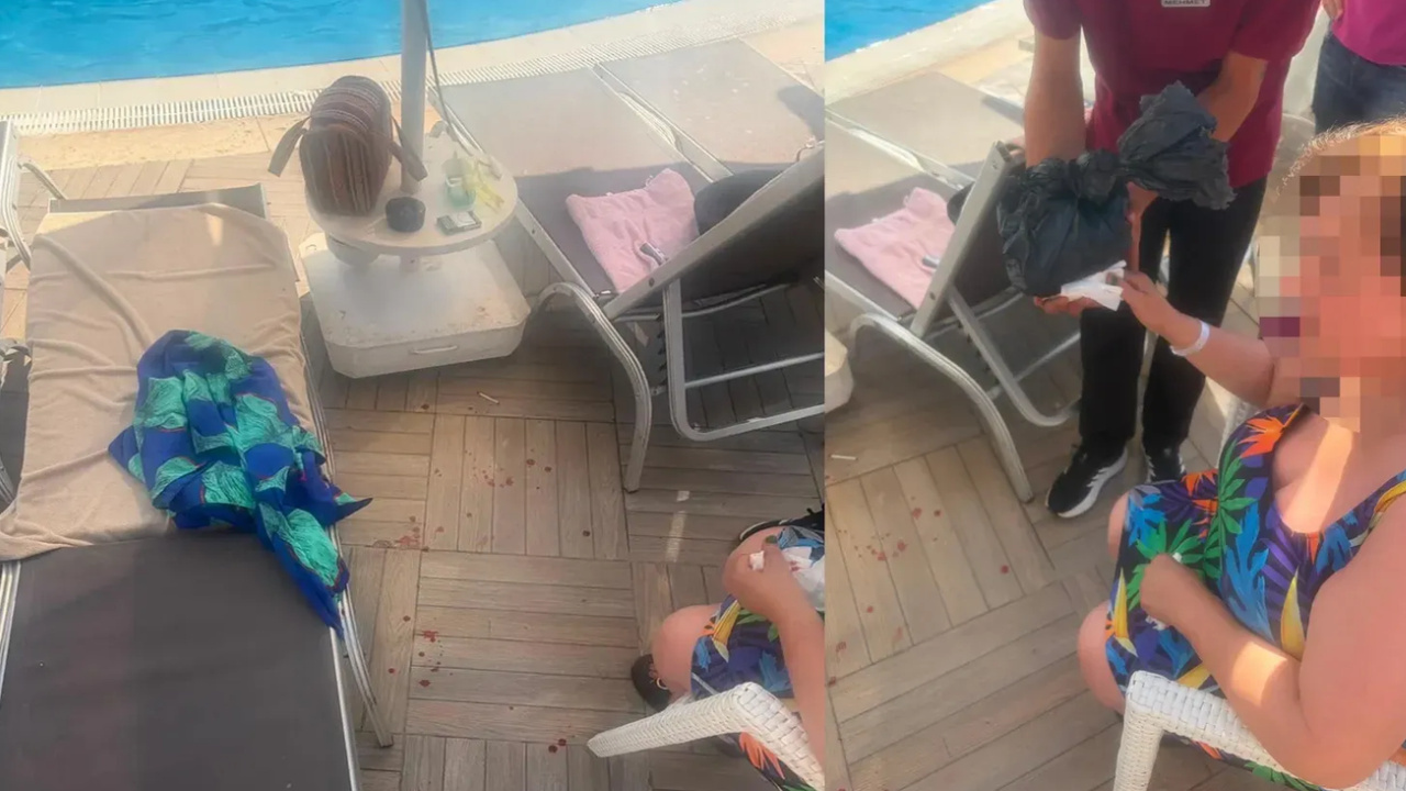 Bodrum'da otelde şezlong faciası! Makas gibi kapanıp parmak kopardı