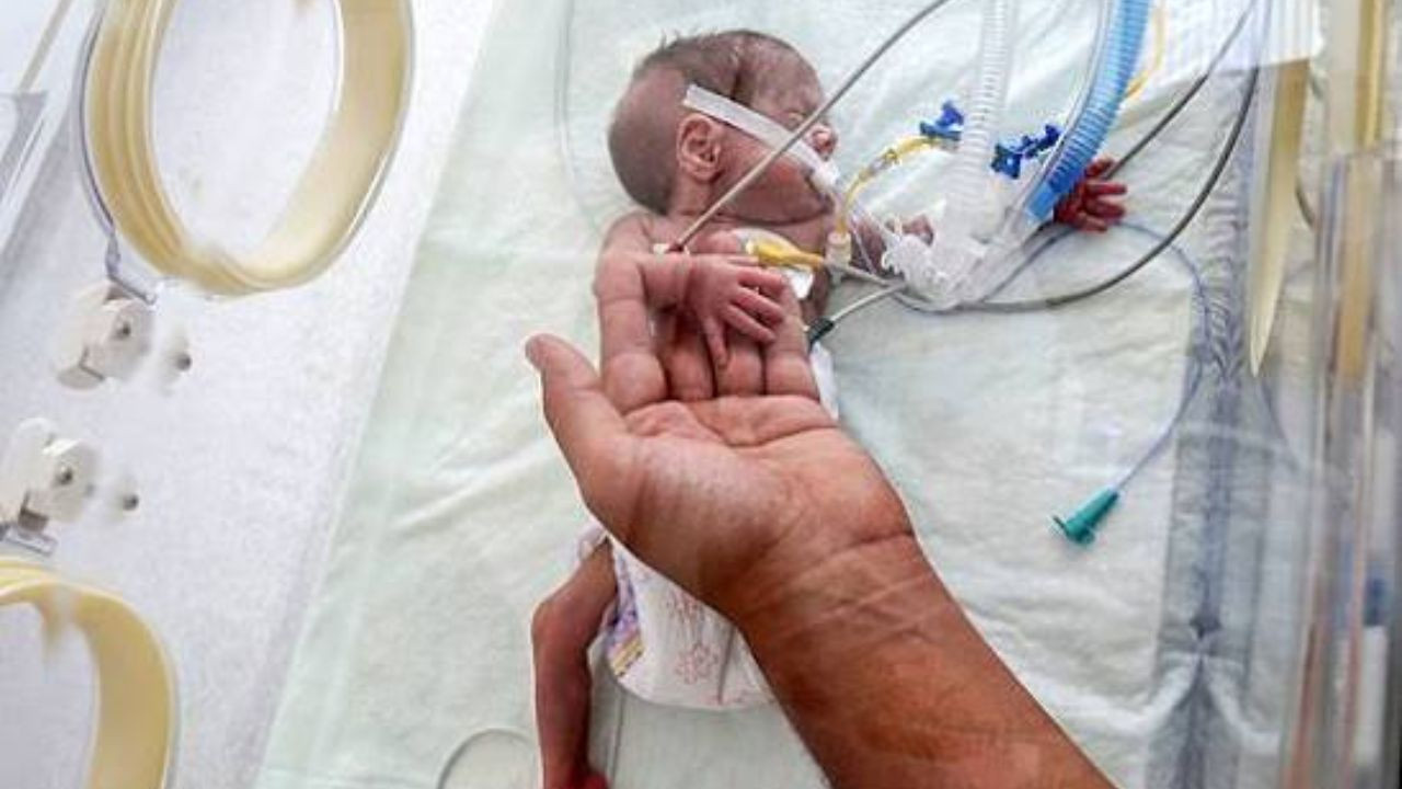 610 gram doğan 19 günlük bebek Ordu'da kalp ameliyatına alındı