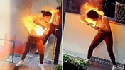 Çantasındaki cihaz patladı, bir anda alevler içinde kaldı! Genç fenomen ölümden döndü