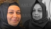 Son Dakika | Eşinin yüzünü parçalayan polis tutuklandı! Cumhurbaşkanı Koruma Dairesi'nden olduğu iddia edilmişti