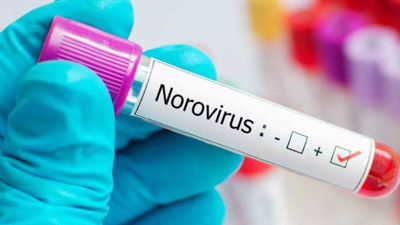 Norovirüs paniği büyüyor! Çocuklar hastalandı, okul kapatıldı
