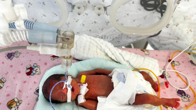 650 gram doğmuştu: Leyla bebek 4 aylık yaşam savaşını kazandı