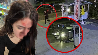 "Konuşacağız" diye çağırıp sokak ortasında dehşeti yaşattılar! Ameliyatlı genç kıza acımasız saldırı