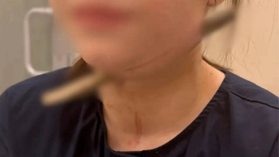 Akıllara durgunluk veren kaza! Oyun oynarken boynuna ağaç dalı saplandı