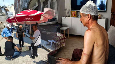 Çay içerken başına beton parçası düştü: 11 dikiş atıldı!