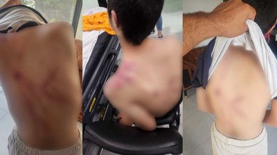 14 yaşındaki down sendromlu çocuğa rehabilitasyon merkezinde şiddet: Valilik "hafif yaralandı" dedi