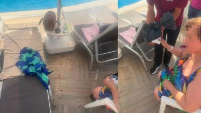 Bodrum'da otelde şezlong faciası! Makas gibi kapanıp parmak kopardı