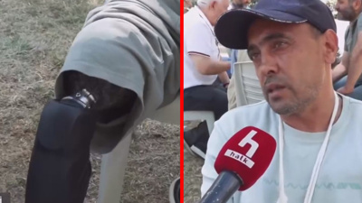 Gazilerin kafaları öne eğdiren "Protez" çilesi! Bu sözler boğaz düğümledi