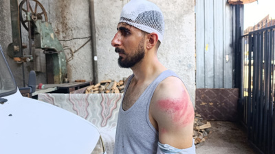 Şanlıurfa’da trafikte dehşet: Önünü kestikleri sürücüyü darbettiler