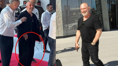 Cem Yılmaz'ın son hali ortaya çıktı: Bastonu attı!