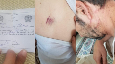 Taliban, Türkmen asıllı tercümana işkence edip tutukladı