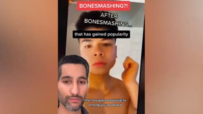 TikTok'ta Yine Korkunç Trend: Yüz Kemiklerini Parçalama Akımı!