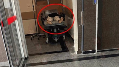 "Türkiye'deki ilk maymun çiçeği vakası" diye paylaşıldı, gerçek sonradan ortaya çıktı