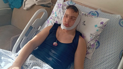 Liseli gencin çenesini kırmışlardı: 4 sanık ilk duruşmada tahliye oldu