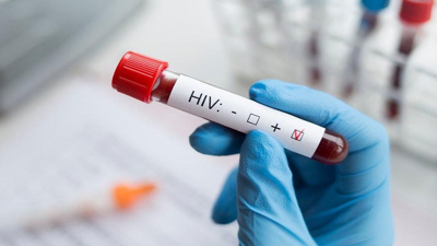 TTB: Son on yılda AIDS vakalarında yüzde 465 artış oldu