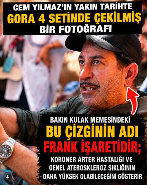 Cem Yılmaz’ın kalbi aylar önce alarm vermiş! Doktor kulaktaki o detayı anlattı - Resim : 2