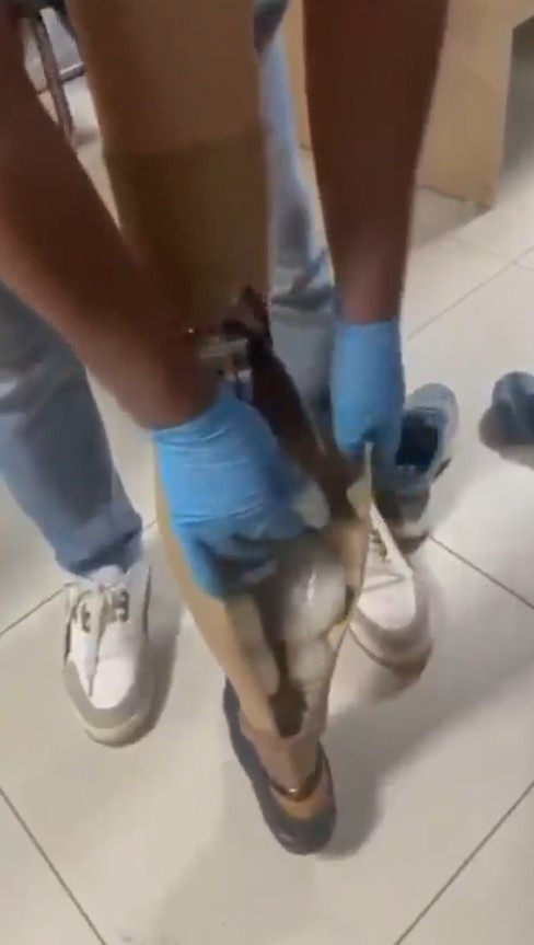 Protez bacağından uyuşturucu çıktı - Resim : 3