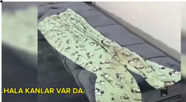 Güllü'nün ölümünde kanlı pijama iddiası! - Resim : 3