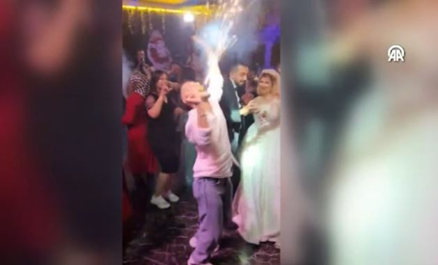 Düğünde korkutan anlar! Ağzındaki meşale bir anda patladı - Resim : 1