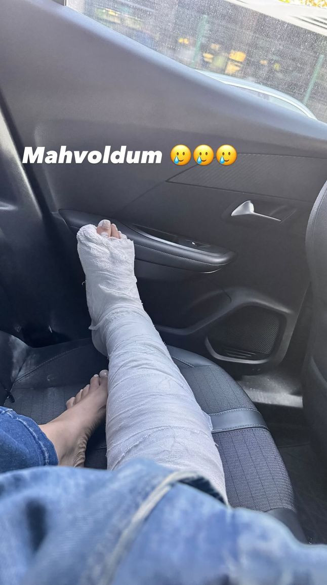 Sevda Demirel yürürken ayağını kırdı! Korku dolu anları saniye saniye kamerada - Resim : 4