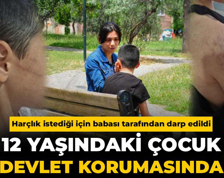 Harçlık istediği için şiddet gören çocuk devlet korumasına alındı