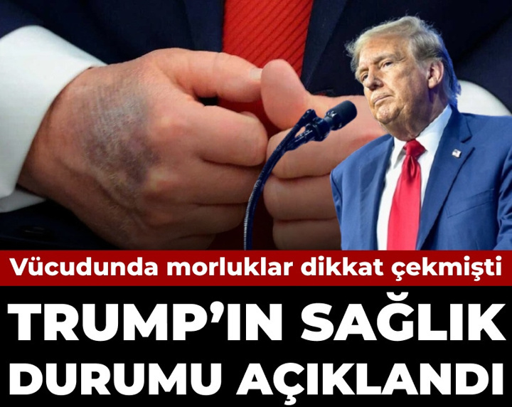 Vücudunda morluklar görülmüştü: Trump'ın sağlık durumu açıklandı