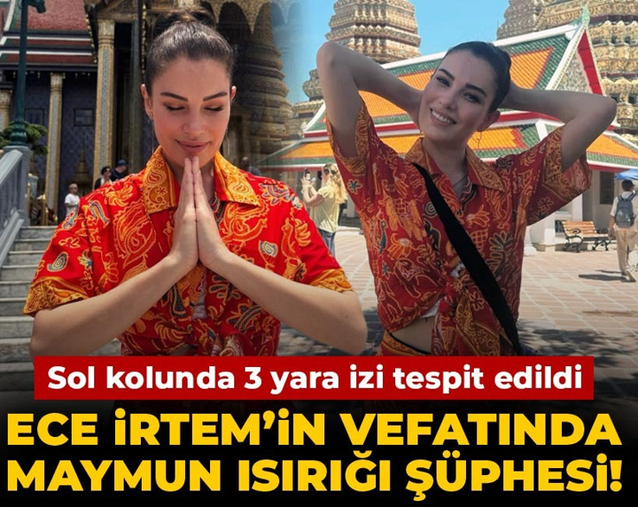 Ece İrtem’in vefatında maymun ısırığı şüphesi
