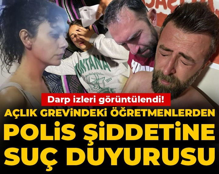 Darp izleri görüntülendi! Açlık grevindeki öğretmenlerden polis şiddetine suç duyurusu