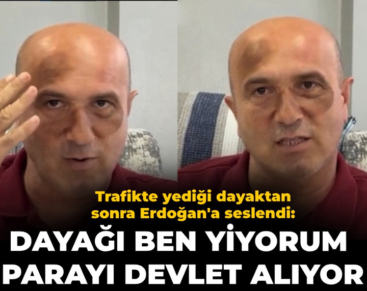 Trafikte yediği dayaktan sonra Erdoğan'a seslendi: Dayağı ben yiyorum parayı devlet alıyor