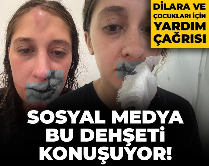 Sosyal medya bu dehşeti konuşuyor: Dilara ve çocukları için yardım çağrısı