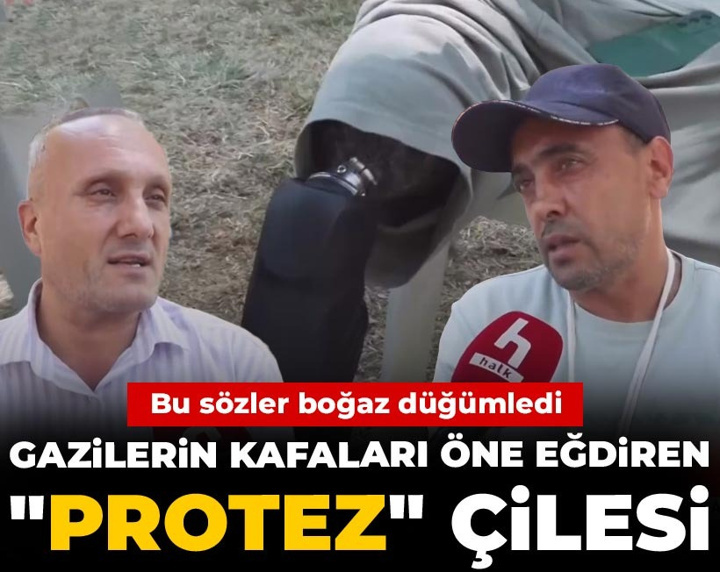 Gazilerin kafaları öne eğdiren "Protez" çilesi! Bu sözler boğaz düğümledi