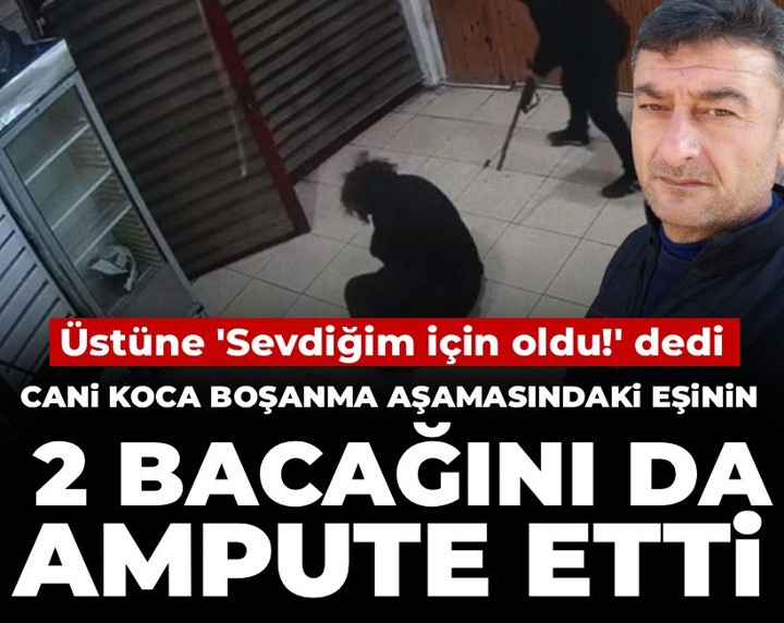 Cani koca boşanma aşamasındaki eşinin 2 bacağını da ampute etti: Üstüne 'Sevdiğim için oldu!' dedi