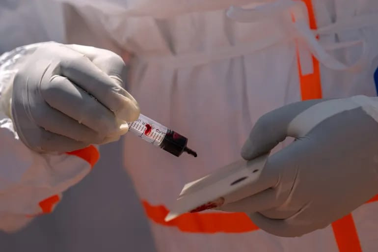 Dünya Kupası'nda Ebola endişesi - Resim : 1