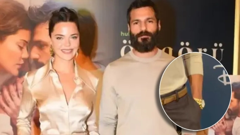 Serkan Çayoğlu'nun tercihi olay oldu: Kolunda servet taşıyor - Fotoğraf: 3