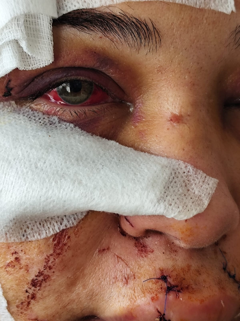 Eşinin yüzünü parçalayan polise ödül gibi ceza verildi! Tırnak makası ile kesti... - Resim : 1