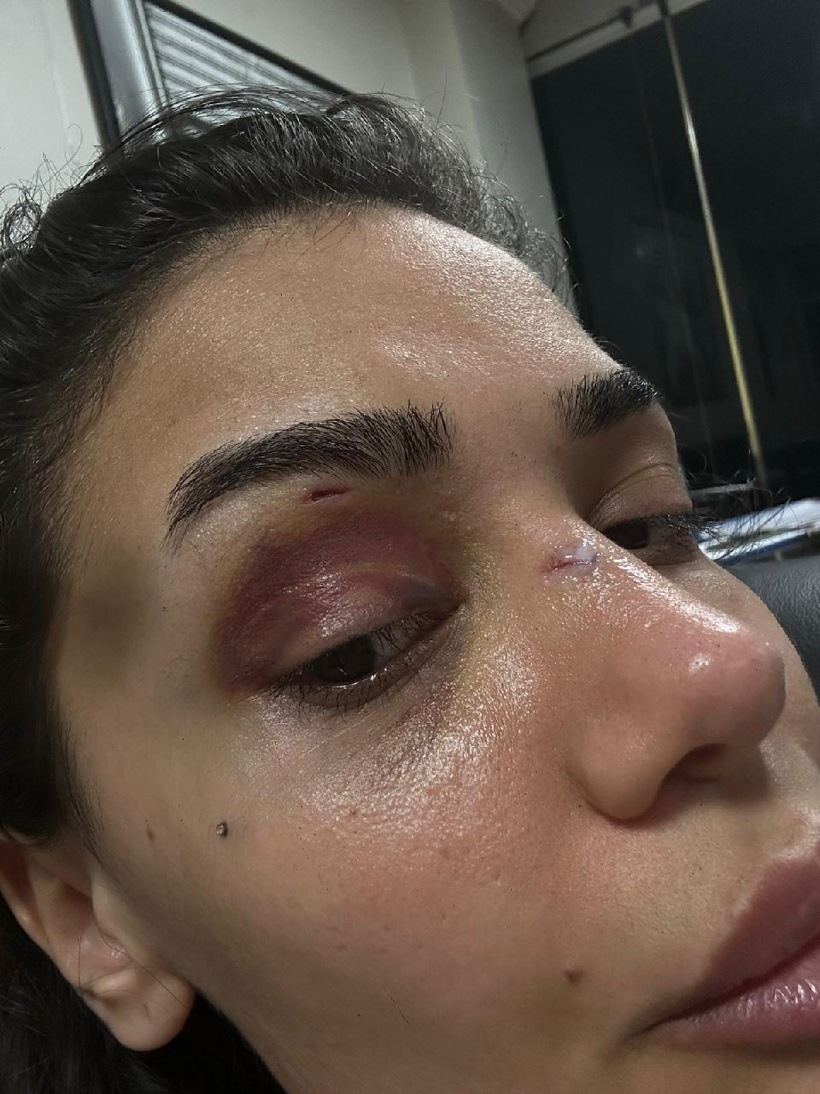 Uzaklaştırma kararına rağmen erkek dehşeti! Genç hemşire "Ölmek istemiyorum" diyerek isyan etti - Resim : 4