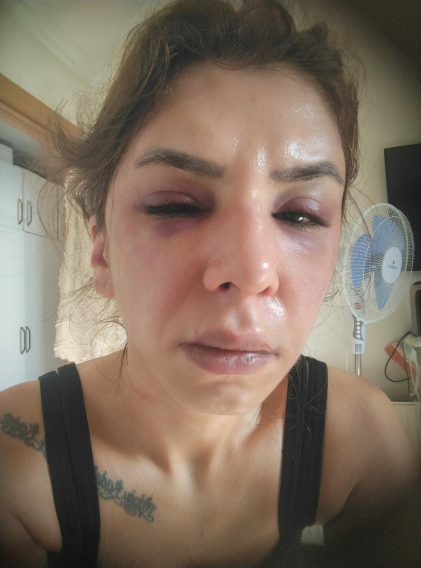 4 saat işkenceye 'yaralama' davası! "Ölmek istemiyorum" - Resim : 3