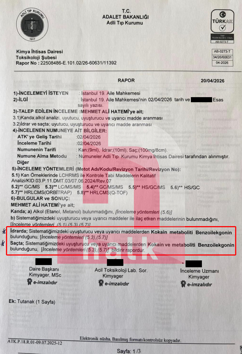 Boşanma davasıyla gündeme gelmişti: Hatemi ailesinin oğlunun uyuşturucu testi pozitif çıktı - Resim : 1