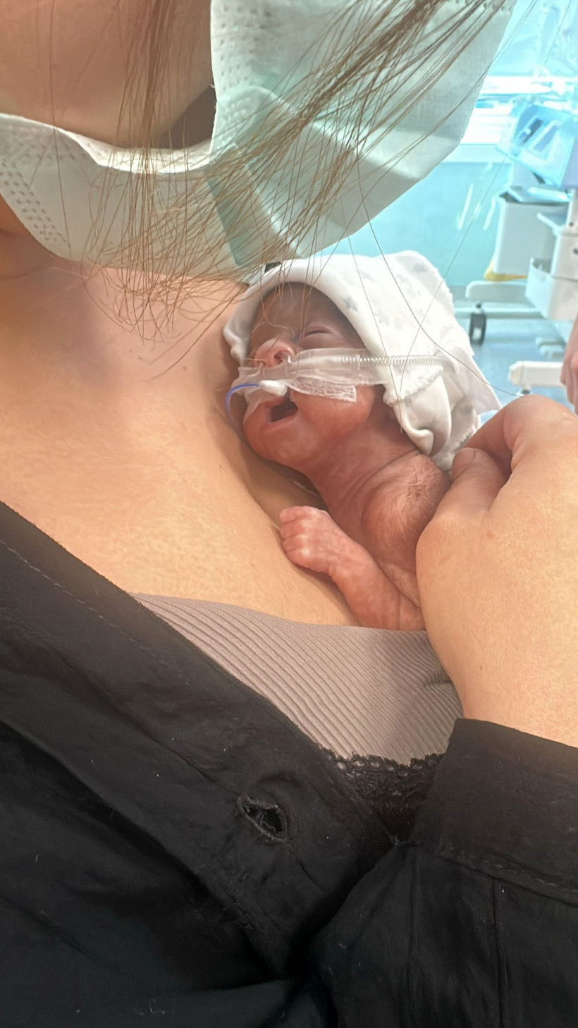 650 gram doğmuştu: Leyla bebek 4 aylık yaşam savaşını kazandı - Resim : 3