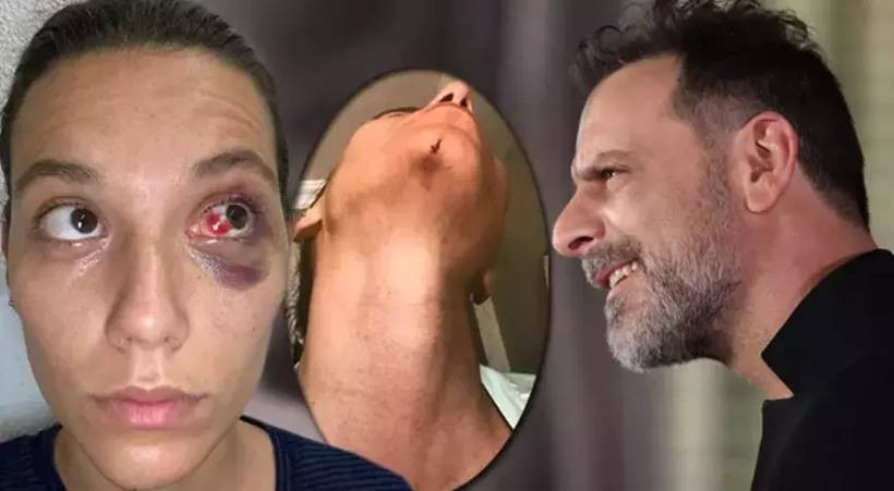 Ozan Güven'in üç büyükşehirdeki oyunlarını peş peşe iptal oldu - Resim : 3