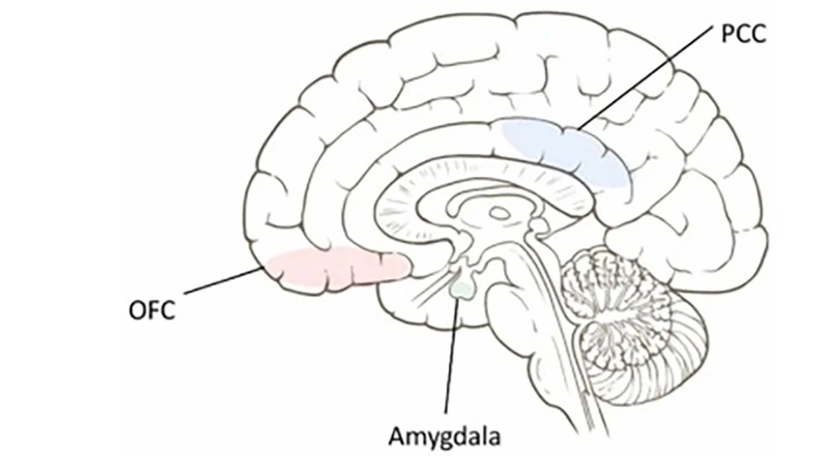 image.webp