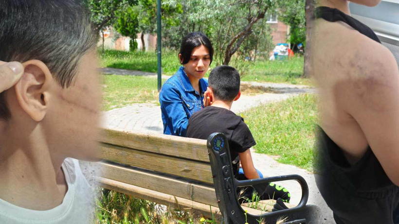 Harçlık istediği için şiddet gören çocuk devlet korumasına alındı