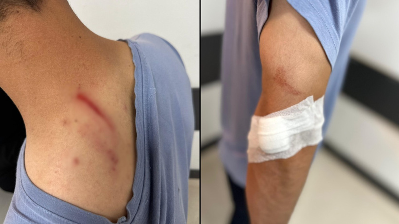 Hastanede şiddet infiali: Tıbbi sekretere çirkin saldırı!