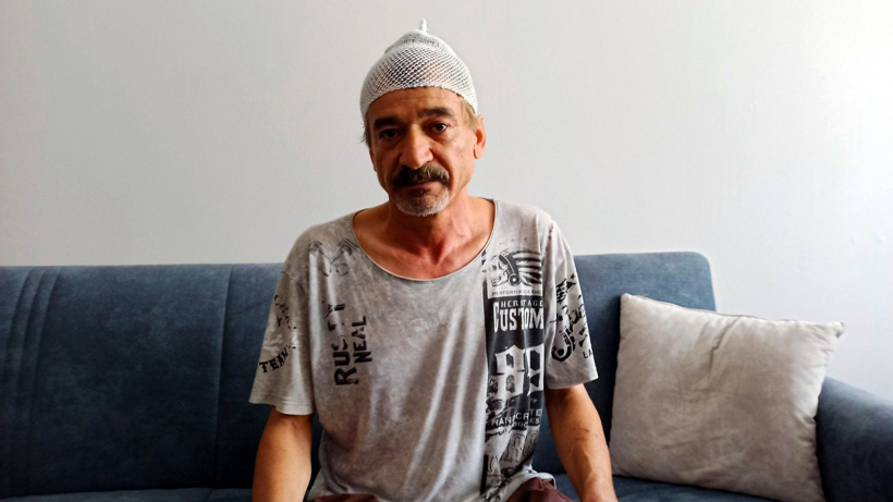 Çay içerken başına 2 katlı binadan beton parçası düştü: 11 dikiş atıldı! - Resim : 1