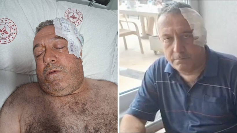 Aşı hatırlatması yapan sağlık memuruna yumruklu saldırı
