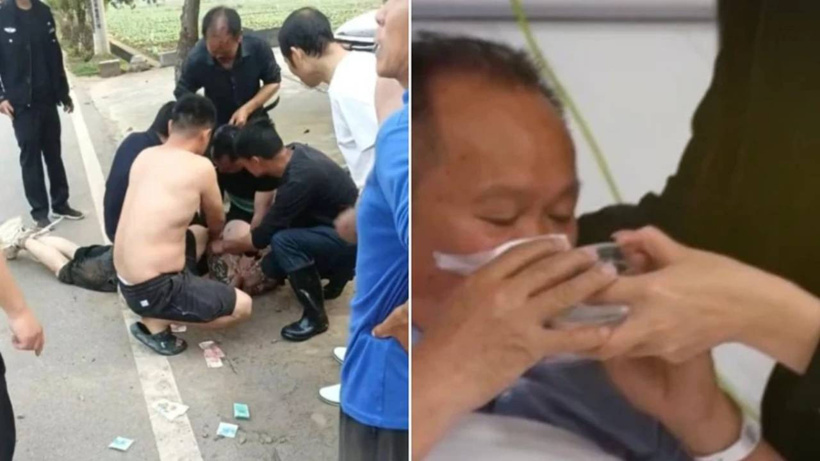 Kadını kurtarmak isterken dehşeti yaşadı! Saldırgan burnunu koparıp yuttu