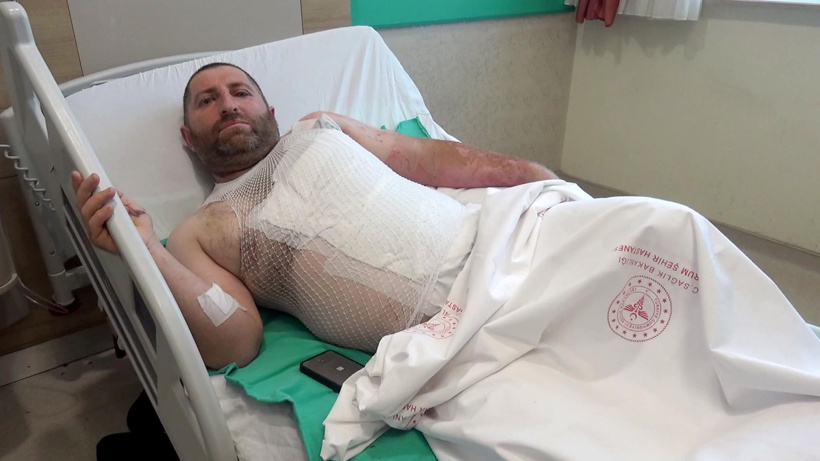 Akıma kapılıp yanarak düştü: Elektriğin şakası yok - Fotoğraf: 3