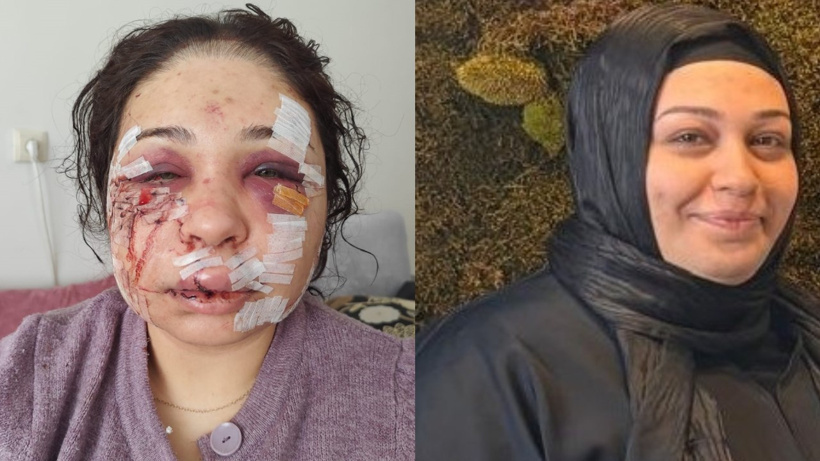 Eşinin yüzünü parçalayan polise ödül gibi ceza verildi! Tırnak makası ile kesti...