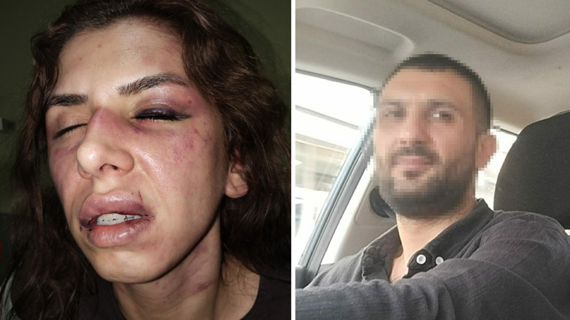 4 saat işkenceye 'yaralama' davası! "Ölmek istemiyorum"
