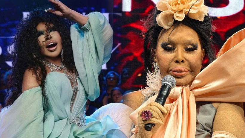 'Lolita estetiği' yaptıran Bülent Ersoy'un son hali ortaya çıktı
